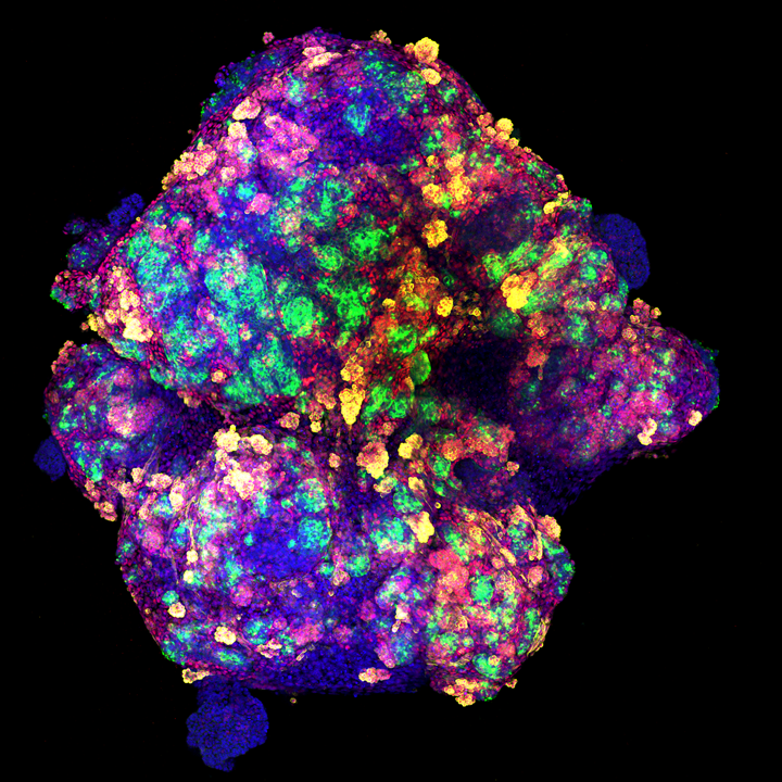 Representative image of a kidney organoid generated in vitro using human pluripotent stem cells. 