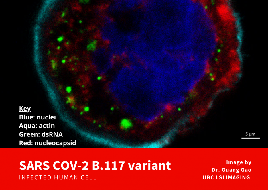 Cell infected with SARS-COV-2 variant B.117