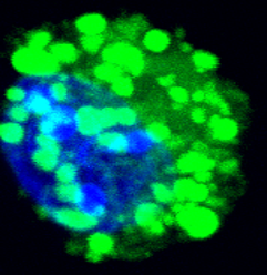 Microscopic image of an alveolar macrophage